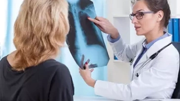 Akciğer Kanseri Belirtileri, Tanı ve Tedavisi
